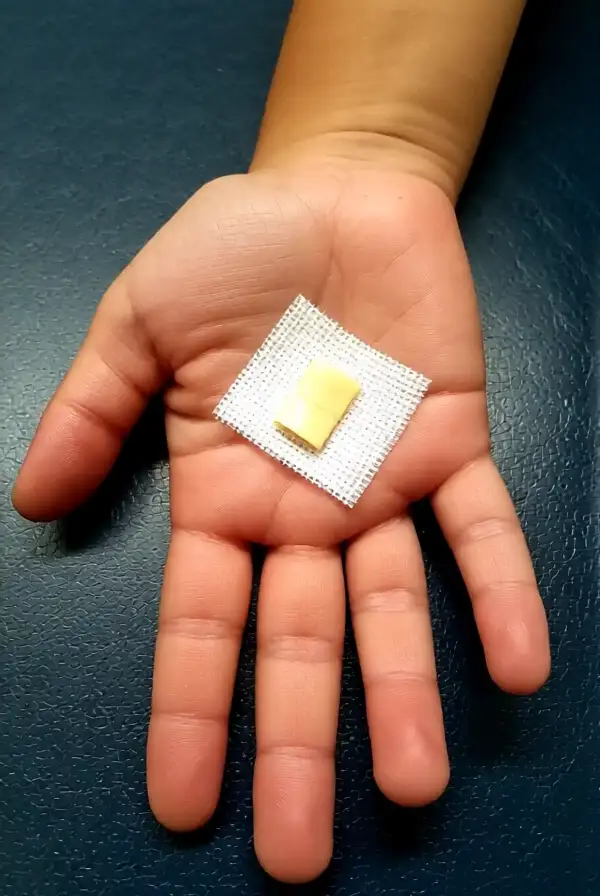 Cuts and Lacerations